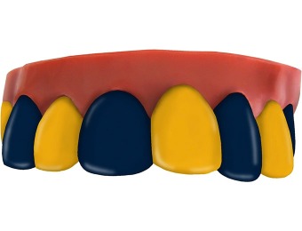 79% off Team Teeth Navy and Gold