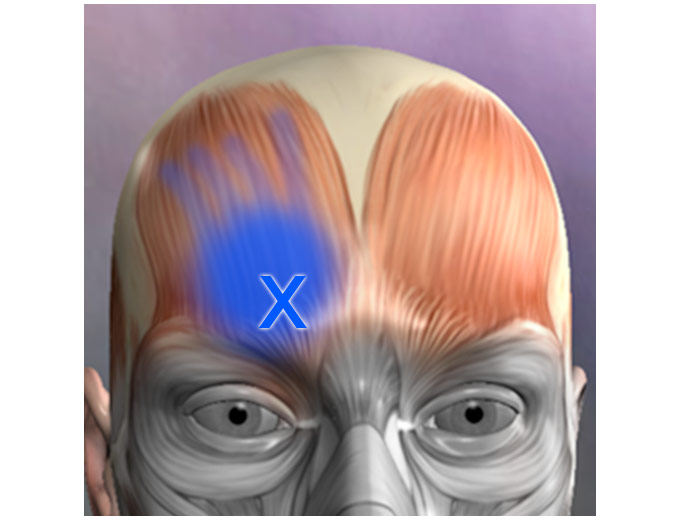 Free Muscle Trigger Point Anatomy Android App